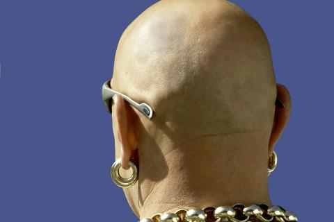 Bald. The Dutch for "bald" is "kaal". Bald. The Dutch for "bald" is "kaal".