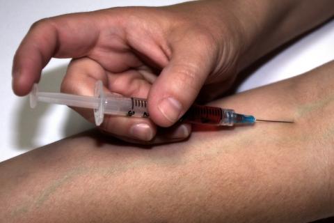 Injection. The Dutch for "injection" is "inspuiting". Injection. The Dutch for "injection" is "inspuiting".