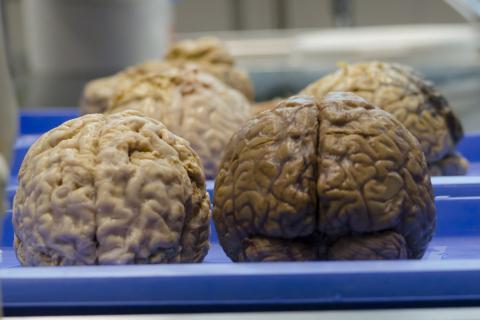 Brain. The Dutch for "brain" is "hersenen".