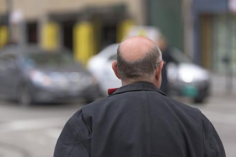 A bald man. The French for "a bald man" is "un chauve". A bald man. The French for "a bald man" is "un chauve".