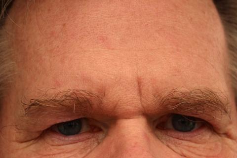 Forehead (informal short form). The Thai for "forehead (informal short form)" is "ผาก". Forehead (informal short form). The Thai for "forehead (informal short form)" is "ผาก".