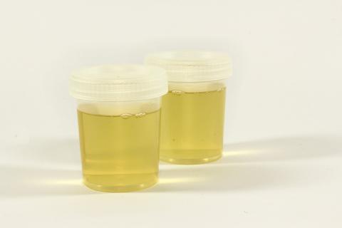 Urine. The Thai for "urine" is "ปัสสาวะ". Urine. The Thai for "urine" is "ปัสสาวะ".